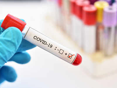 Coronavirus: What you should know about the COVID-19 antibody test